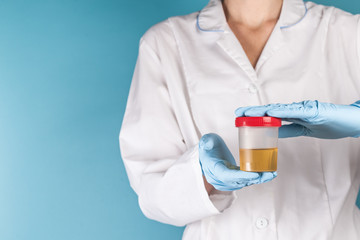 container for urinalysis in the hand of the doctor