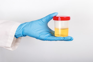 test tube with a urine test in the doctor's gloved hand