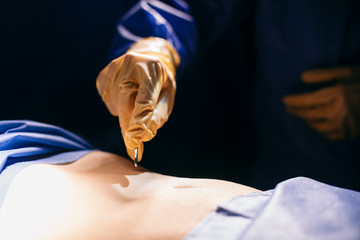 Close-up of surgeon making an incicion during an operation