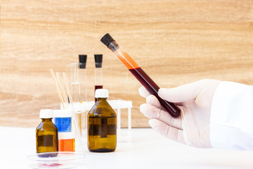 Blood in test tubes. Laboratory for taking blood tests. Coronovirus test