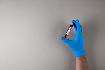Hand in blue rubber sterille glove holding test tube with sample