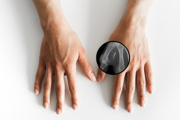 Hand with implantation of micro chip. X-Ray view close-up. Chipization of people, control population.