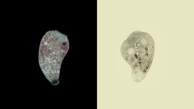 Infusoria Stentor under the microscope, the family Stentoridae, class Ciliata, feed on small organic residues, bacteria, algae, protozoa.
