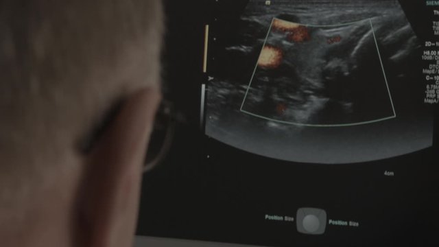 ultrasound doctor examines a pregnant girl, belly of a pregnant girl