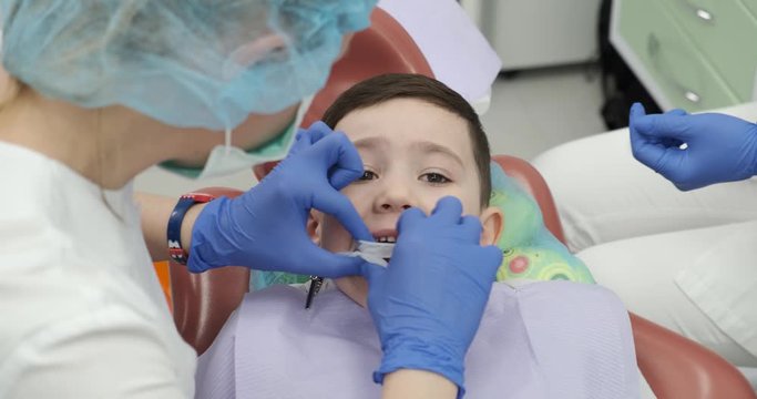 Little patient at the dentist's appointment. Girl doctor gently inserts gag to brush teeth of boy. Gag was inserted into boy’s mouth, now the doctor can work and not afraid. Child safety is important