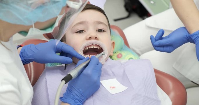 Schoolboy at dentist's appointment. Serious gagged boy suffering from brushing teeth. Dentist uses sterile tools apply cleaning paste to patient’s teeth. Child smiles, he likes procedure. Kids dental