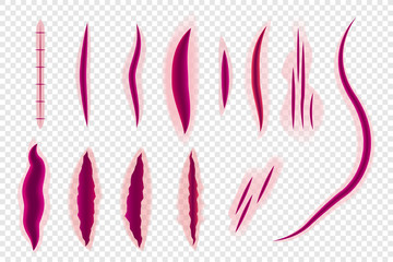 Bloody scar, Realistic wounds and stitch. Skin wound set. Vector illustration.
