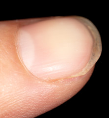 A finger on a man’s hand is isolated on a black background.