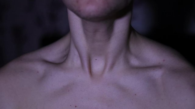 A man having a having seizure,contracting muscle neck and shoulder muscles