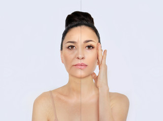 Aging. Mature woman-young woman.Face with skin problem.Showing photos before and after	