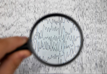 A neurologist examines an encephalogram of a patient’s brain. Schedule of electroencephalograms -...