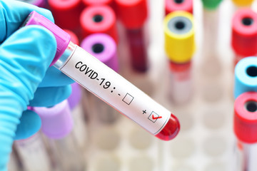 Obraz premium Blood sample tube positive with COVID-19 virus 