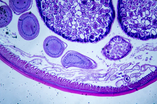 Microscopic image of Ascarid (cross-section)