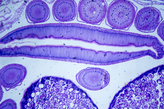 Microscopic image of Ascarid (cross-section)