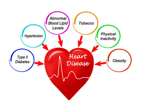 Six Causes of Heart Disease