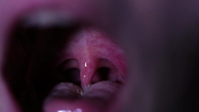 A pan though inside of infected red persons mouth