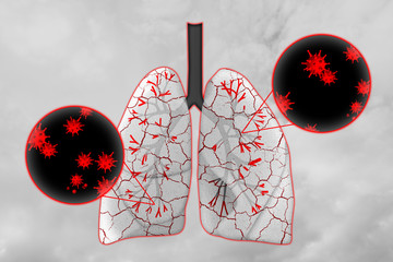 Illustration of human lungs affected with disease on light background
