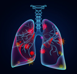 Illustration of human lungs affected with disease on dark background