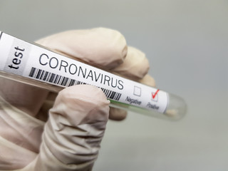 Test sample positive swab for coronavirus COVID-19