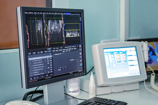 The monitor shows the results of a lung scan, in the background the patient undergoes an MRI or CT scan.