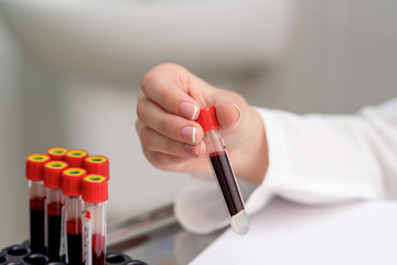 Doctor hand holding test tube with blood sample, close up.