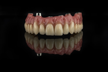 macro prosthesis with teeth photographed on a black background