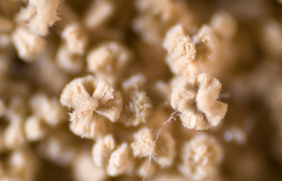 Aspergillus (mold) Under Microscope View In Laboratory.