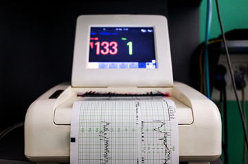 front view of a medical machine that measures the baby's heartbeat. Machine that monitors the baby's condition before birth