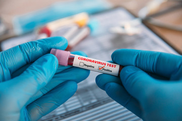 Doctor Holding Pandemic Coronavirus 2019-nCoV Blood Sample Positive Test Tube. Doctor wearing medical mask and gloves and shows patient's blood test tube containing corona virus (COVID-19)