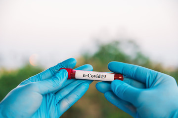 Obraz premium Doctor Holding Pandemic Coronavirus 2019-nCoV Blood Sample Positive Test Tube. Doctor wearing medical mask and gloves and shows patient's blood test tube containing corona virus (COVID-19)