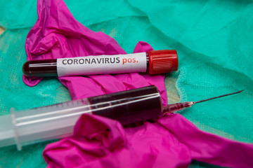 Positive testing at coronavirus