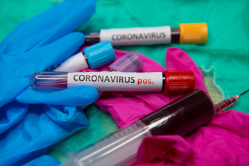 Positive testing at coronavirus