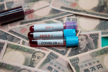 Japanese yen and positive test at coronavirus.