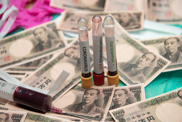 Japanese yen and positive test at coronavirus.