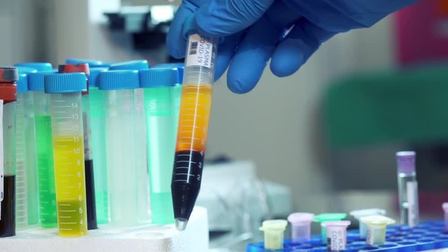 A laboratory tech replaces a vial of blood plasma from a survivor of COVID19 coronavirus back into the storage holder.
