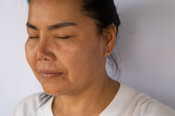 Fototapeta premium An Asian woman with the Nasolabial folds (cheeks lines) and skin problem such as wrinkles and dark spots on her face.