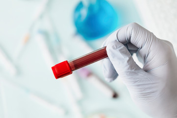 Hand of doctor holding a blood test tube during covid-19 outbreak