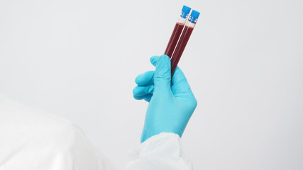 Male model with PPE suite and Hand with glove is holding blood collection tube on white background.