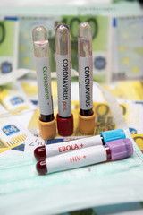 Positive testing at HIV,Ebola and Coronavirus