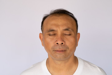 Obraz premium Hair loss Asian man showing all side of his bald head