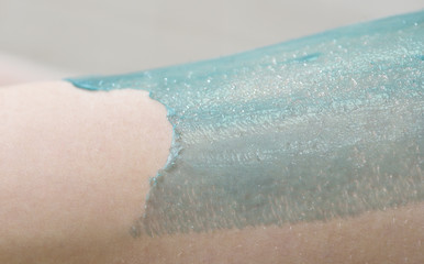 The process of female waxing. Beautician removes wax with hair from female legs.