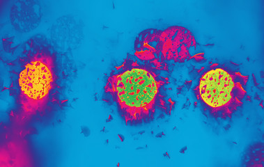 Abstract colored background - virus or bacteria under the microscope.
