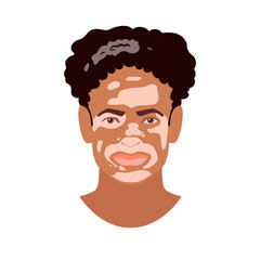 Beautiful young African man face with Vitiligo disorder texture. Skin condition that causes loss of melanin. Сute boy heads isolated on white background. Stock vector illustration in flat style