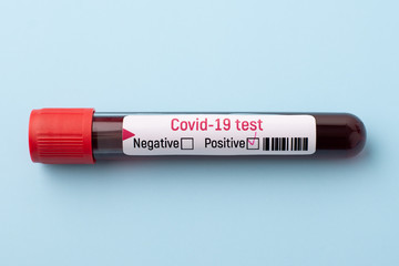 Test-tube with blood. Testing blood on covid-19 virus