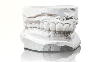 medicine, tooth, dentistry, impression, prosthesis, dentist, dental, cast, implant, denture,...