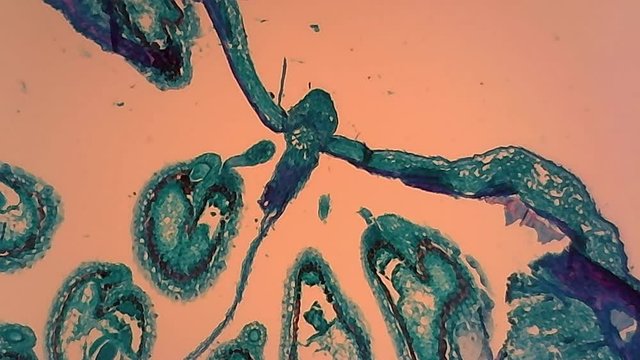 Microscope Embryo of Shepherd Section x1200