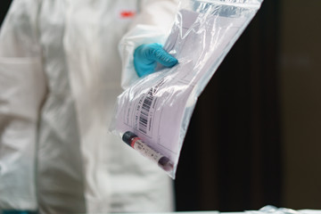 Coronavirus testing, a hand holds transparent bag with tube of blood test samples of coronavirus (COVID-19).