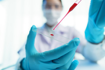 Lab technician dripping blood on slide glass for blood group test in hospital laboratory.
