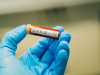 Obraz premium gloved hand showing a blood sample for analysis