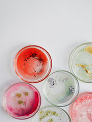 Viruses and bacteria in a Petri dish, studying the growth of bacteria on different samples in the...